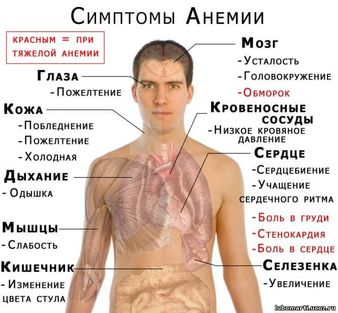 схема симптомом анемии