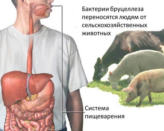 Бруцеллез симптомы у человека, профилактика и лечение