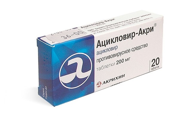 Опоясывающий герпес, симптомы и лечение у взрослых