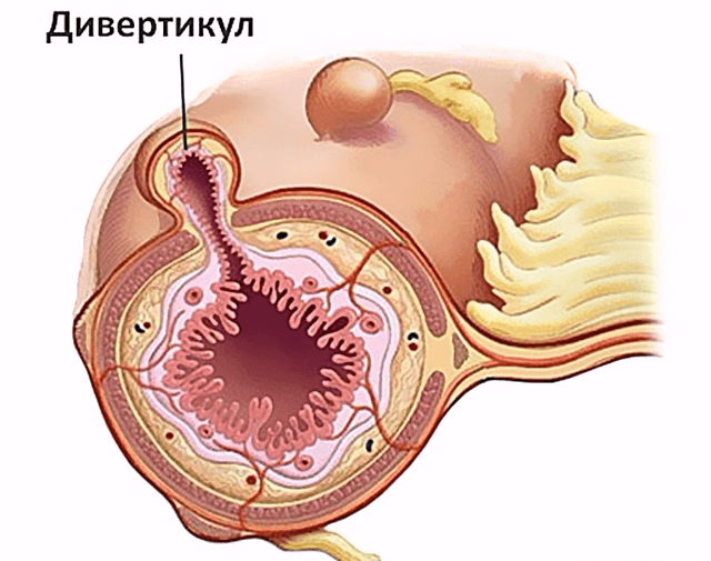 Алмагель А: инструкция по применению