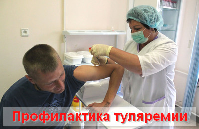 Туляремия, что это такое? Симптомы и лечение у человека