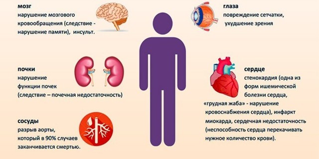 Лечение гипертонии 2 степени, симптомы и причины возникновения