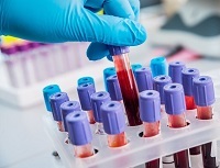 Первые симптомы аутоиммунного гепатита, диагностика и схема лечения