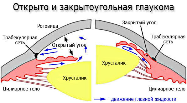 Симптомы глаукомы, лечение и профилактика