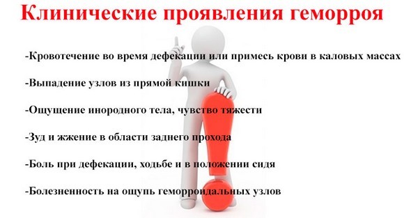 Наружный геморрой: симптомы, фото и способы лечения