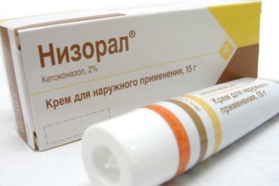 Как лечить себорейный дерматит на лице в домашних условиях