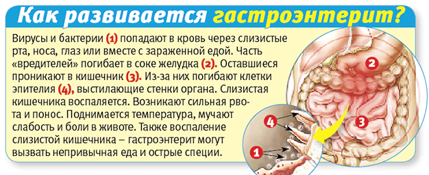 Гастроэнтерит у взрослых: симптомы, причины и схема лечения