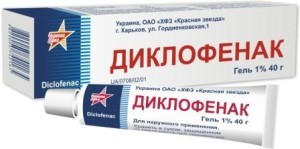 Артроз коленного сустава: симптомы и схема лечения