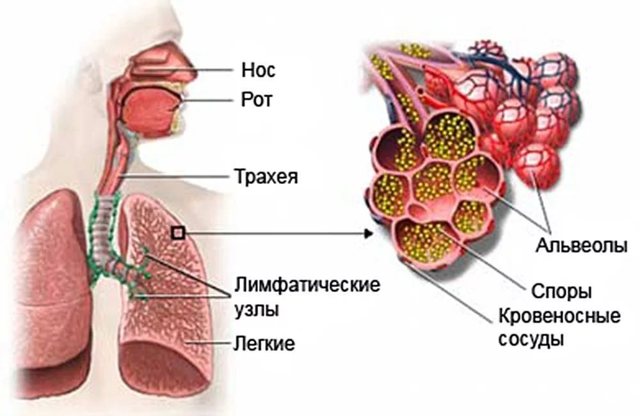 Аспергиллез: симптомы у человека, диагностика и лечение