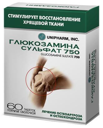 Артроз коленного сустава: симптомы и схема лечения