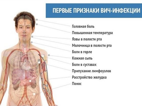 Первые признаки ВИЧ у мужчин и женщин, основные симптомы ВИЧ указывающие на заражение