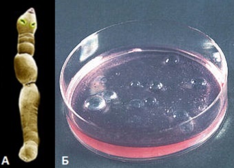 Альвеококкоз: признаки, причины и схема лечения у человека