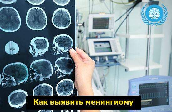 Симптомы и лечение менингиомы головного мозга — прогноз и последствия после удаления опухоли