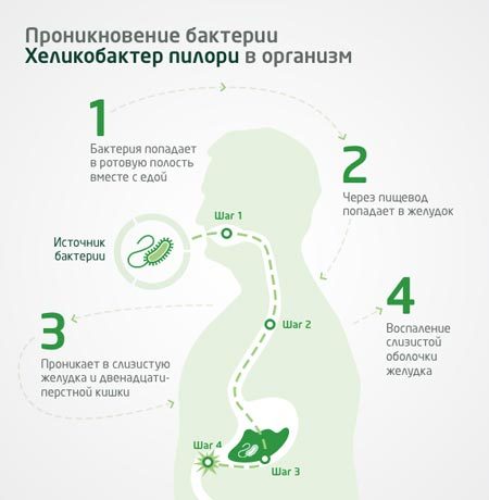 Гастродуоденит: что это такое, симптомы и лечение