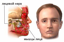 Симптомы неврита лицевого нерва и актуальные схемы лечения
