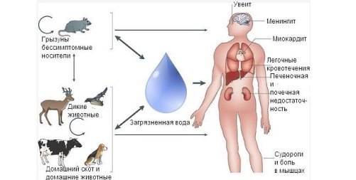 Лептоспироз у человека: симптомы, причины и лечение
