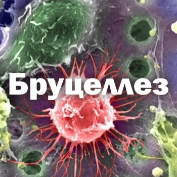 Бруцеллез симптомы у человека, профилактика и лечение