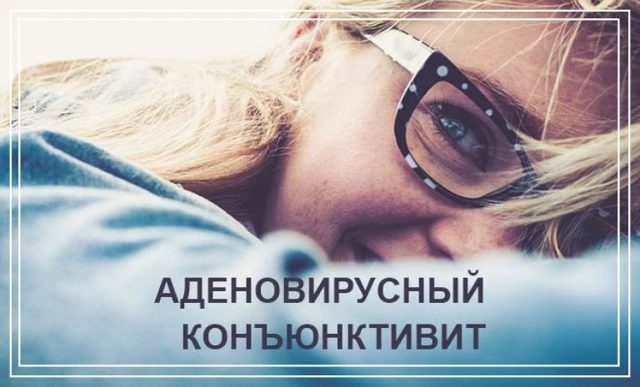 Аденовирусный конъюнктивит: фото, симптомы и лечение