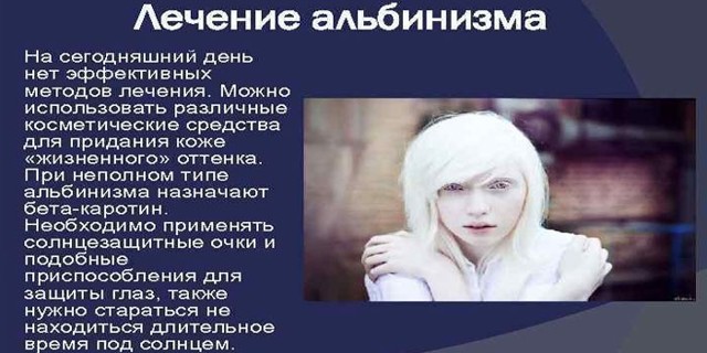 Альбинизм у человека: признаки, причины и лечение