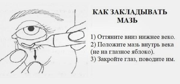 Аденовирусный конъюнктивит: фото, симптомы и лечение