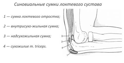 Бурсит локтевого сустава: фото, симптомы и лечение