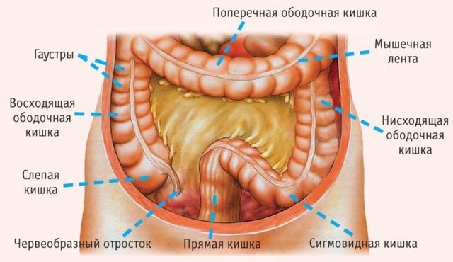 Сигмоидит, что это такое? Симптомы и лечение