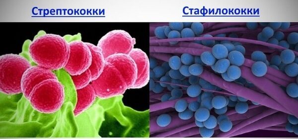 Пиодермия, что это такое? Симптомы, причины и лечение