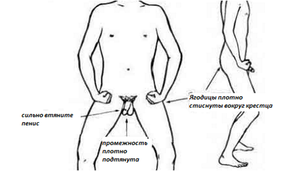 Можно ли вылечить хронический простатит в домашних условиях?