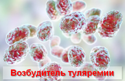 Туляремия, что это такое? Симптомы и лечение у человека