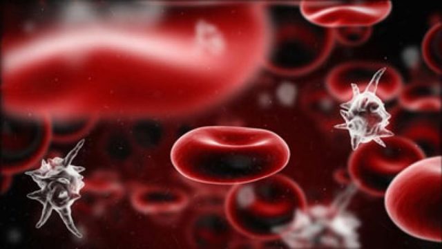 Сепсис у взрослых: симптомы и лечение
