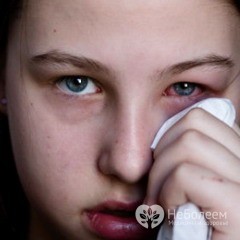 Симптомы конъюнктивита у взрослых, лечение и меры профилактики