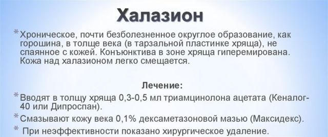 Что такое халязион: симптомы и лечение