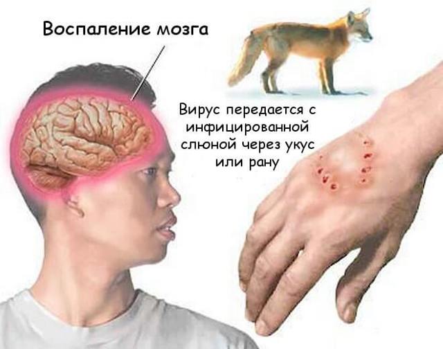Бешенство: инкубационный период у человека, симптомы и диагностика
