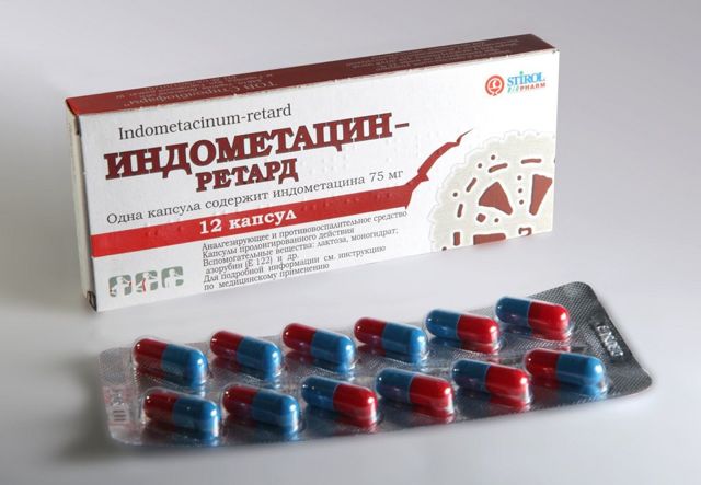 Артроз коленного сустава: симптомы и схема лечения