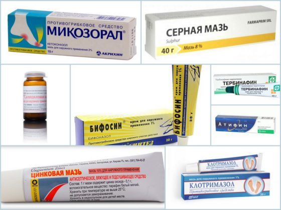 Список мазей от грибка ногтей на ногах: эффективные и недорогие препараты