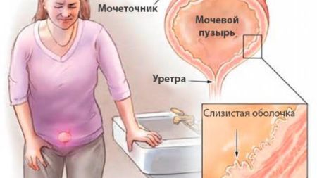 О чем говорит слизь в моче