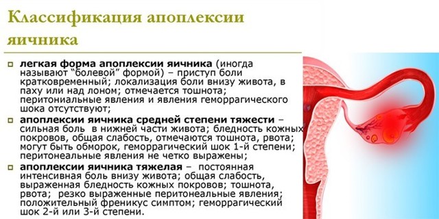 Апоплексия яичника: первые симптомы, причины и варианты лечения