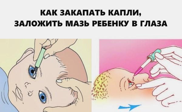 Чем лечить конъюнктивит у детей в домашних условиях
