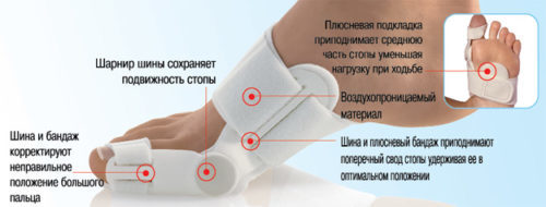 Бурсит большого пальца стопы: симптомы и схема лечения