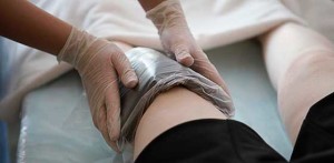 Артроз коленного сустава: симптомы и схема лечения
