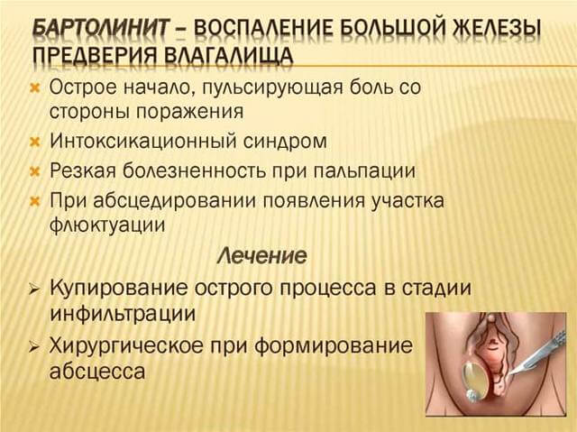 Как лечить кисту бартолиновой железы