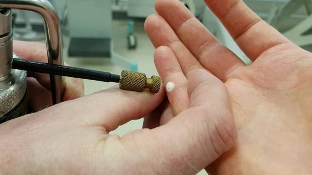 Болезнь Боуэна: что это такое? Симптомы и схема лечения