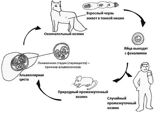 Альвеококкоз: признаки, причины и схема лечения у человека