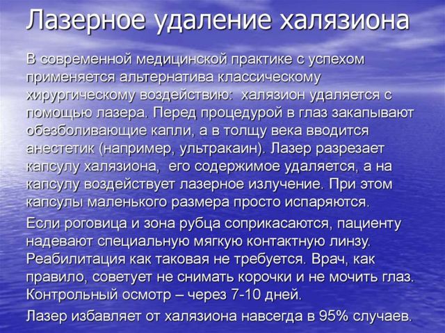 Что такое халязион: симптомы и лечение