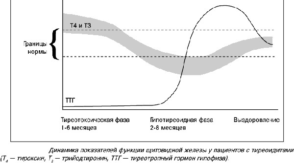 Аутоиммунный тиреоидит щитовидной железы