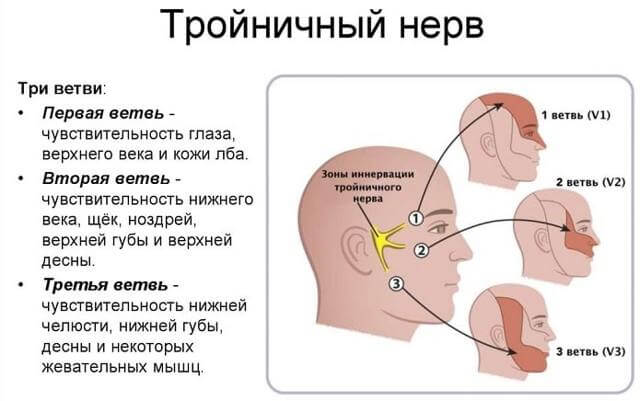 Как лечить невралгию тройничного нерва в домашних условиях