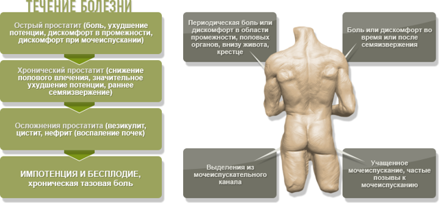 Аденома предстательной железы: симптомы, лечение и прогноз